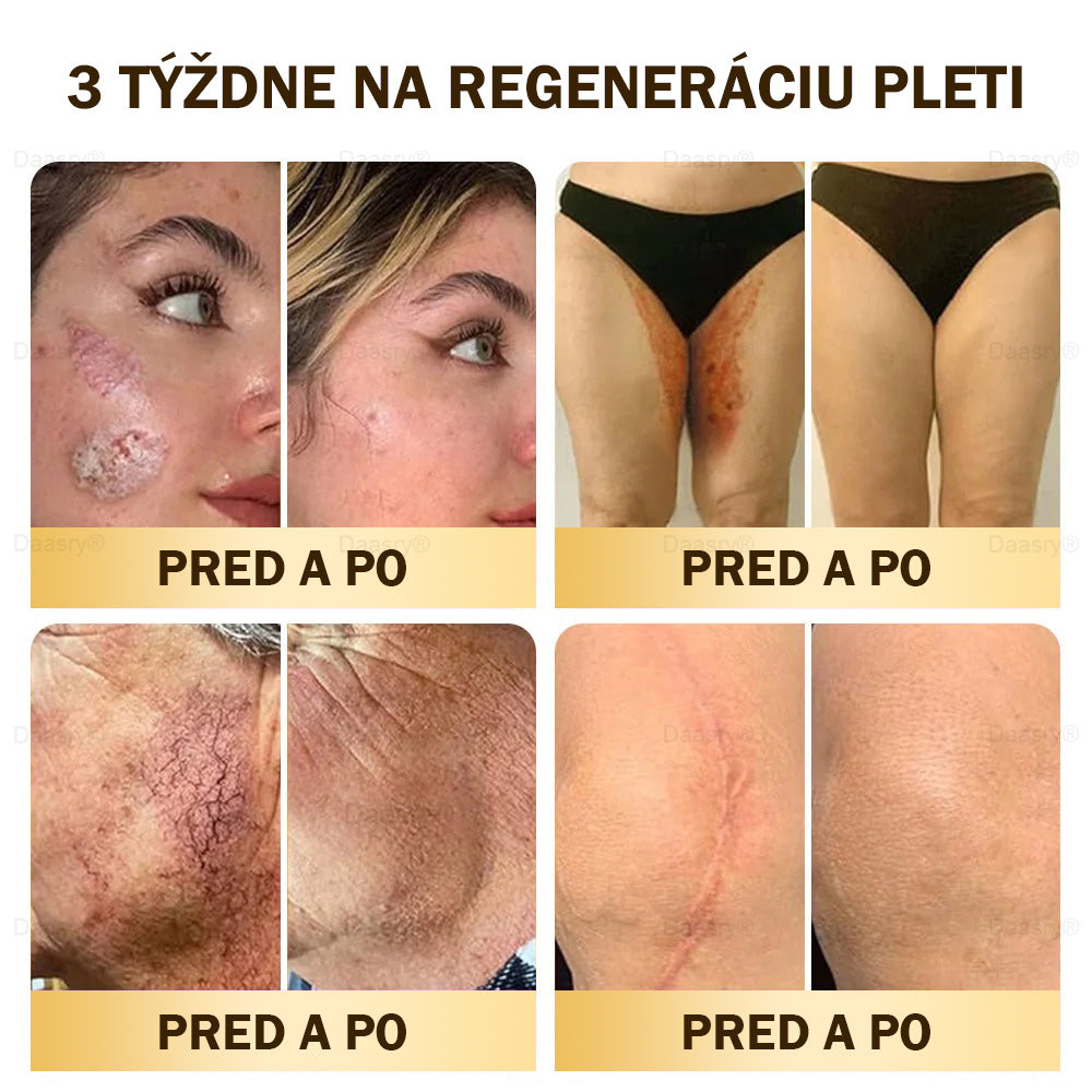 🎇𝓓𝓪𝓪𝓼𝓻𝔂® krém s včelím jedom – na opravu pokožky a proti starnutiu.Pomáha vyhladzovať vrásky, hydratuje, rozjasňuje pleť, podporuje hojenie jaziev.Upokojuje citlivú pokožku a zjednocuje tón pleti