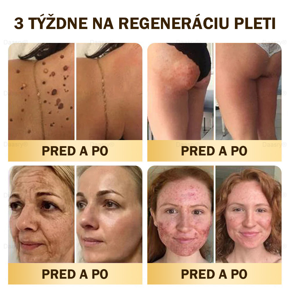 🎇𝓓𝓪𝓪𝓼𝓻𝔂® krém s včelím jedom – na opravu pokožky a proti starnutiu.Pomáha vyhladzovať vrásky, hydratuje, rozjasňuje pleť, podporuje hojenie jaziev.Upokojuje citlivú pokožku a zjednocuje tón pleti