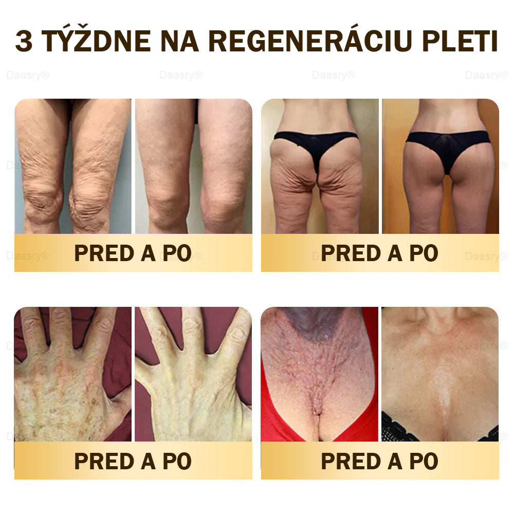 🎇𝓓𝓪𝓪𝓼𝓻𝔂® krém s včelím jedom – na opravu pokožky a proti starnutiu.Pomáha vyhladzovať vrásky, hydratuje, rozjasňuje pleť, podporuje hojenie jaziev.Upokojuje citlivú pokožku a zjednocuje tón pleti