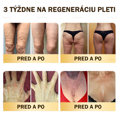 🎇𝓓𝓪𝓪𝓼𝓻𝔂® krém s včelím jedom – na opravu pokožky a proti starnutiu.Pomáha vyhladzovať vrásky, hydratuje, rozjasňuje pleť, podporuje hojenie jaziev.Upokojuje citlivú pokožku a zjednocuje tón pleti