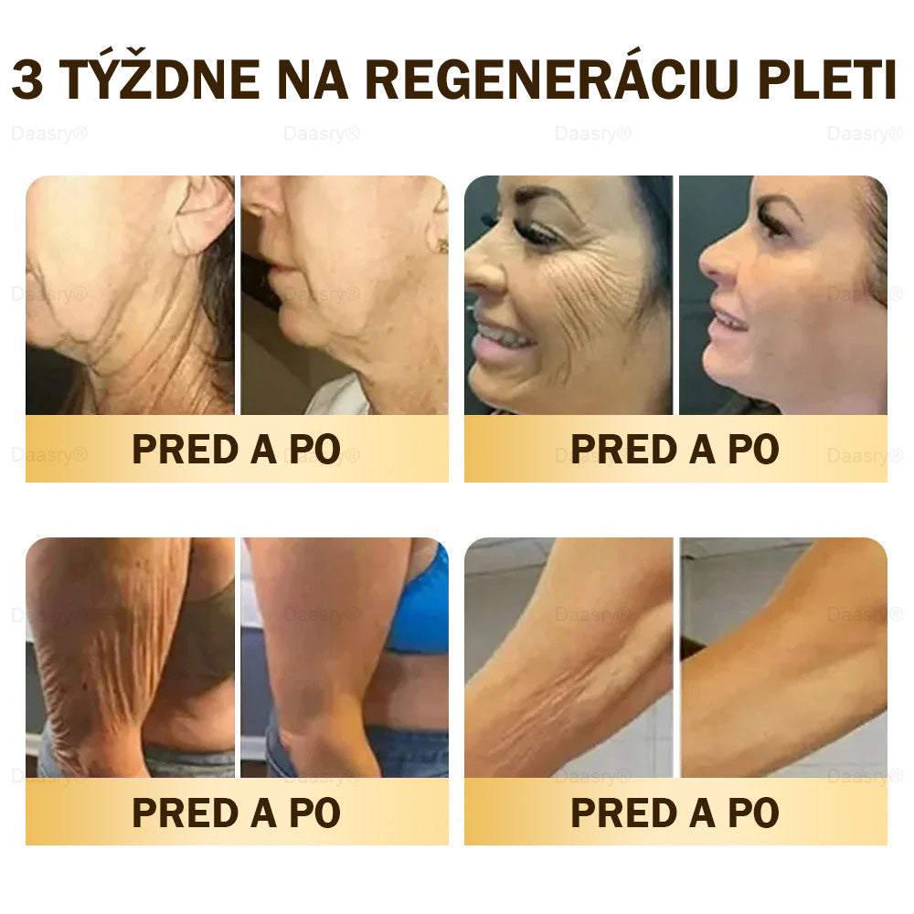 🎇𝓓𝓪𝓪𝓼𝓻𝔂® krém s včelím jedom – na opravu pokožky a proti starnutiu.Pomáha vyhladzovať vrásky, hydratuje, rozjasňuje pleť, podporuje hojenie jaziev.Upokojuje citlivú pokožku a zjednocuje tón pleti