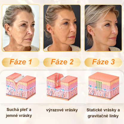 🎇𝓓𝓪𝓪𝓼𝓻𝔂® krém s včelím jedom – na opravu pokožky a proti starnutiu.Pomáha vyhladzovať vrásky, hydratuje, rozjasňuje pleť, podporuje hojenie jaziev.Upokojuje citlivú pokožku a zjednocuje tón pleti