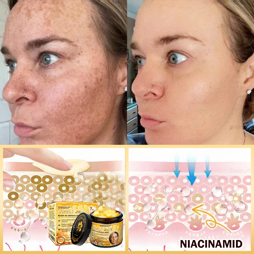 🎇𝓓𝓪𝓪𝓼𝓻𝔂® krém s včelím jedom – na opravu pokožky a proti starnutiu.Pomáha vyhladzovať vrásky, hydratuje, rozjasňuje pleť, podporuje hojenie jaziev.Upokojuje citlivú pokožku a zjednocuje tón pleti